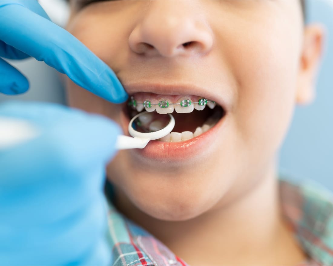 Orthodontics, Kelowna Dentist